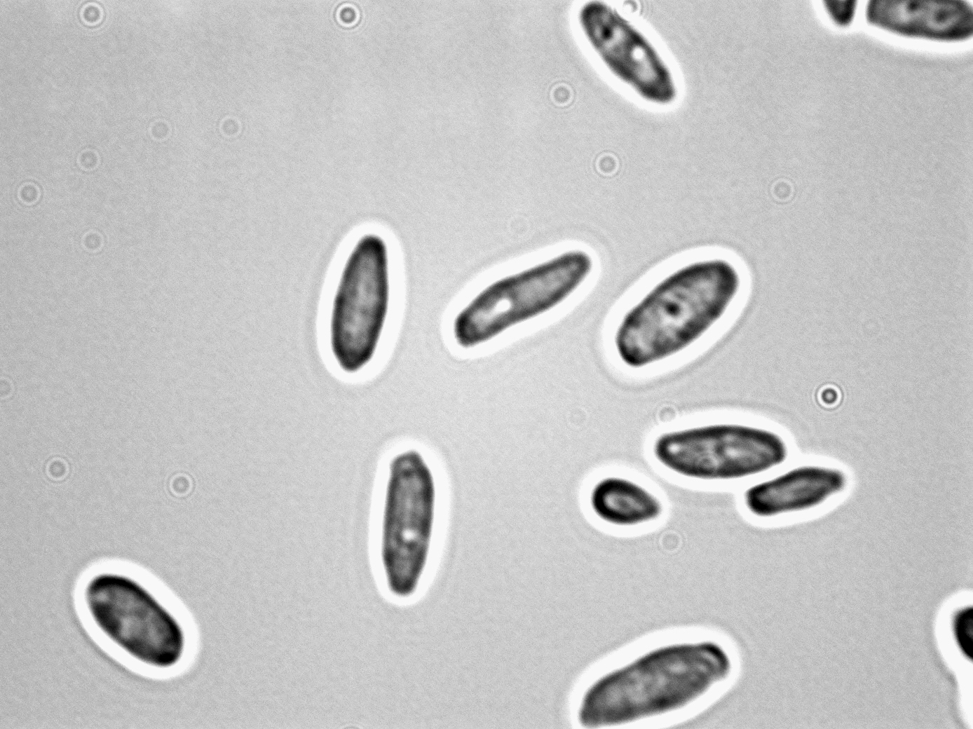 Candida krusei clearance